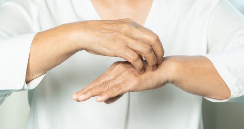 Best Products For Eczema On Hands